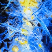 Ping Liu – “The Light of Hope” – 3485711642@QQ.com