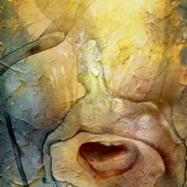 James (2) Img #1 Tonsillectomy