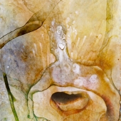 James (3) Img #1  Tonsilectomy